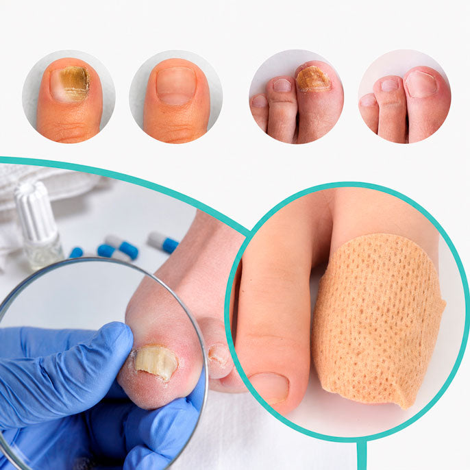Alivoria™ NailRenew Patches